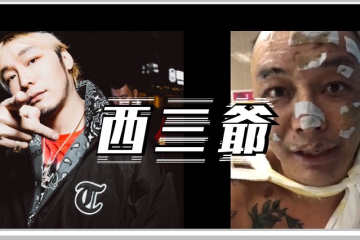 因家中意外失火，徐真真全身40%二级深度烧伤...