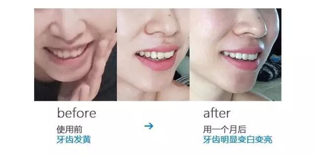 用了1年的健齿白，牙还这么黄，如何让我的笑容更有力量？